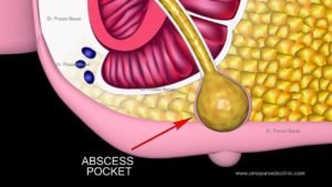 Sandhya Raman Aadhar Foundation